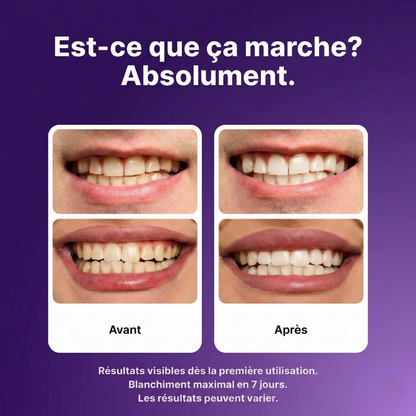 Bandes Blanchissantes Correctrices de Couleur - Smilekit™